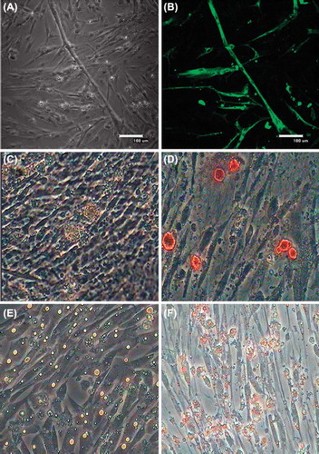 Figure 7. Skeletal muscle satellite cells differentiate into myogenic, osteogenic and adipogenic cells. A. Skeletal muscle satellite cells initiated terminal differentiation to form multinucleated myotubes; B. MHC was expressed in the differentiated cells; C. Skeletal muscle satellite cells produced calcified nodules on the sixth day; D. Alizarin red staining was used to to detect calcium nodules; E. A large number of lipid droplets formed in differentiating cells on day 6; F. lipid droplets were stained with Oil-Red O.