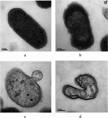 Figure 3. TEM photographs of E. coli cells. (a) Untreated bacteria. (b, c, and d) Bacteria treated with ultrasound for 20 min.[Citation67].