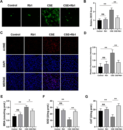 Figure 4 Rb1 ameliorated CSE-induced oxidative stress in BEAS-2B cells. (A) ROS was measured using DCFH-DA fluorescence probe in BEAS-2B cells after Rb1 treatment. (B) Quantification of intensity of the DCFH-DA fluorescence. (C) Representative images of DHE staining. (D) Quantitative analysis of DHE-positive cells. (E–G) The levels of MDA, SOD and CAT. *P<0.05, **P<0.01.