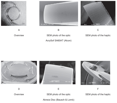 Figure 1 In the photos above you note the sharp posterior edge of the IOLs used in the study. A) Overview of AcrySof SA60AT (Alcon). B) Scanning electron microscopy (SEM) photo of the optic of AcrySof SA60AT showing it’s sharp posterior edge. C) SEM photo of the haptic of AcrySof SA60AT, showing that it has the same sharp edge as the optic. D) Overview of Akreos Disc (Bausch and Lomb). E) SEM photo of the sharp posterior edge of the optic of Akreos Disc. F) SEM photo of the haptic of Akreos Disc showing that it has sharp egde as well.