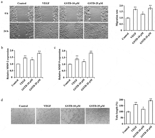 Figure 2. Gastrodin promotes the migration and tube formation of HUVECs A: determination of cell migration ability using scratch test; B: assessment of the expression of MMP-2 using qRT-PCR; C: assessment of the expression of MMP-9 using qRT-PCR; D: evaluation of cell tube formation ability using tube formation test. * p < 0.05; ** p < 0.01. GSTD, gastrodin