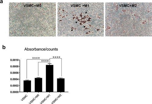 Figure 1 The effect of macrophages on VSMC calcification. VSMCs were cocultured with the 3 macrophage subtypes in calcification-inducing medium (ANOVA, ****Stands for p<0.0001). (a) Alizarin red staining revealed calcification in the cocultures of different macrophage subtypes and VSMCs (the location of calcification nodules was marked with black arrows). (b) Cetylpyridinium chloride assays were used to quantify calcification levels in the cocultures. M1 macrophages significantly induced calcification in VSMCs.