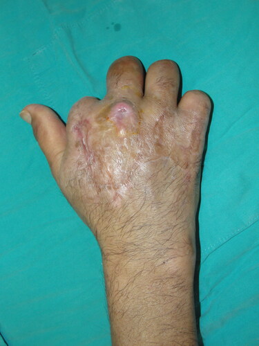 Figure 7. Post-operative 8th-month image of the patient.