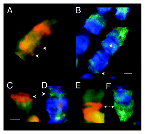 Figure 2. Fluorescent (FITC green) Mab F7–26 ssDNA antibody complex and acridine orange staining of RNase-treated syncytia within tubular syncytia of fetal spinal cord ganglia (9 wks). (A, C, and E) Acridine orange staining showing various spatial distributions of bright orange fluorescence in syncytial bell shaped nuclei. (B, D, and F) Anti-ssDNA labeling (FITC green) of bell shaped nuclei in the same samples with DAPI (blue) staining of dsDNA. Arrows emphasize the similarity of distribution of both modes of ssDNA recognition starting at the rim of the mouths of the nuclei. Scale bar, 5 µm. Images by Gostjeva EV, Fomina JN, and Darroudi F.