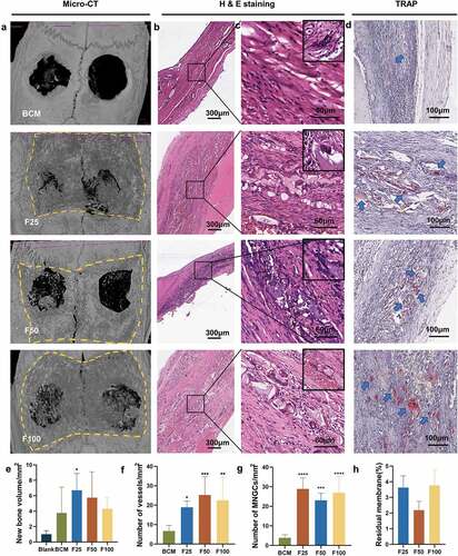 Figure 4. Degradation and integration properties of F-mBCM at the calvarial defect at 4 weeks following surgery. (a) Micro-CT revealed the residual membrane of F-mBCM over the calvarial defect (yellow area). (b, c) H&E staining showed that the residual membrane was surrounded by fibrous tissue and MNGCs. (d) TRAP staining showed the presence of TRAP+ MNGCs (blue arrows). Semi-quantitative analysis of (e) new bone volume, (f) the number of vessels, (g) the number of MNGCs, and (h) the percentage of residual membrane area. * Significant differences compared with the blank or BCM groups. *, P < 0.05, **, P < 0.01, ***, P < 0.001, ****, P < 0.0001, data without * were not significantly different (NS). Error bars represented mean ± SD.