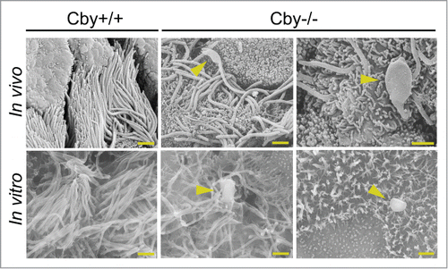 Figure 1. Ciliated cells of Cby−/− airways display a bulge morphology at the ciliary tip. Shown are scanning electron micrographs of adult Cby+/+ (left column) and Cby−/− (middle and right columns) mouse bronchial airways (In vivo; top row) and ALId21 MTECs (In vitro; bottom row). Both Cby−/− bronchial airways and MTECs demonstrated a paddle-like ciliary morphology with dilated distal tips (arrowheads). In addition to cilia, the apical surface of ciliated cells contains numerous microvilli. Scale bars: 1 µm.