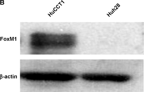 Figure S2 Expression of FoxM1 in HuCCT1 and Huh28.