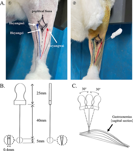 Figure 1 (A) ① The positions of the 3 sinew points for treatment are shown, the diamond marks the position of the popliteal fossa contour, the blue line marks the medial gastrocnemius, and the red marks the lateral gastrocnemius. ② Direction of the acupotomy. (B) The acupotomy specification drawing. (C) The simple diagram of the operation of acupotomy at sinew points.