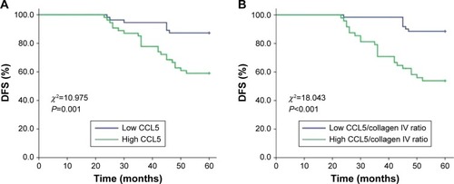 Figure 4 CCL5 and CCL5/collagen IV ratio and 5-DFS.Notes: (A) CCL5 and 5-DFS, the cutoff value was 54.5; the 5-DFS of these two groups was significantly different (P=0.001, log-rank test). (B) CCL5/collagen IV ratios and 5-DFS, the cutoff value was 0.79; the 5-DFS of these two groups was significantly different (P<0.001, log-rank test).Abbreviations: CCL5, chemokine (C–C motif) ligand 5; 5-DFS, 5-year disease-free survival.