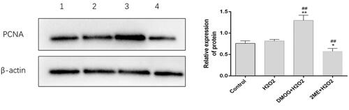 Figure 7. HIF-1α up-regulated PCNA expression. 1: control; 2: H2O2; 3: DMOG + H2O2; 4: 2ME + H2O2. Western blot analysis: PCNA and β-actin were detected, PCNA was normalized to β-actin as an internal control. The data shown are the means of three independent experiments. The error bars represent standard error. Data were analyzed with one-way analysis of variance (∗p < .05, ∗∗p < .01, vs. control; ##p < .01, vs. H2O2).