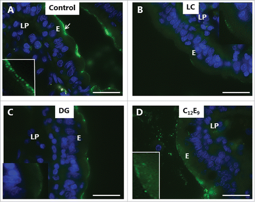 Figure 6. Inhibition of enterotoxin uptake by PEs. Mucosal explants cultured for 1 h in the presence of 10 µg/ml FITC-LTB and in the absence (A) or presence of 2 mM of LC (B), DG (C) or C12E9 (D). A: Punctate labeling with FITC-LTB is seen at, and below, the apical surface of the enterocytes. B-D: Reduced labeling at the apical surface and only few subapical punctae. In the presence of C12E9, a diffuse staining of the apical cytoplasm was seen. (Inserts in A and D show enlarged image details.) The images shown of each situation are representative of at least 5 images. Bars: 20 µm.