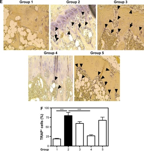 Figure 6 Biomarkers of bone formation and resorption.Notes: Therapeutic effect of CH-DEAE15/siRNA-TNFα, folate-PEG-CH-DEAE15/siRNA-TNFα and naked siRNA-TNFα nanoparticles on serum bone marker levels in CAIA mice. (A) Serum ALP on day 10. (B) Serum OC on day 10. (C) Serum PINP on day 10. (D) Serum TRAP levels. (E) Immunostaining showing TRAP-positive cells indicated by black arrows. (F) Percentage of TRAP-positive cells in each group. Statistical significance was assessed by unpaired Student’s t-test, *P<0.05, **P<0.01, ***P<0.001. Group 1: normal control; group 2: CAIA control; group 3: CAIA mice treated with DEAE15-CH/siRNA-TNFα nanoparticles; group 4: CAIA mice treated with folate-PEG-CH-DEAE15/siRNA-TNFα nanoparticles; group 5: CAIA mice treated with siRNA-TNFα.Abbreviations: ALP, alkaline phosphatase; CAIA, collagen antibody-induced arthritis; CH, chitosan; CTX-II, C-terminal telopeptide type II collagen; DEAE, diethylethylamine; ELISA, enzyme-linked immunosorbent assay; OC, osteocalcin; PEG, polyethylene glycol; PINP, procollagen I N-terminal peptide; SEM, standard error of the means; TNFα, tumor necrosis factor-alpha; TRAP, tartrate-resistant acid phosphatase.