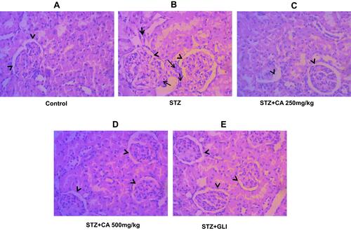 Figure 9 Histological evaluation of diabetic kidney after treatment with CA. (A) Kidney tissues of control animals. (B) sloughing of the cells of the proximal tubules in kidney after STZ-induced diabetes. Architecture of kidney tissues treated with CA leaves extracts (C, D) and glibenclamide (E).