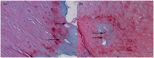 Figure 3. The junction between the CF and subchondral bone is highly irregular in contrast to the junction between UF and CF. There is a jigsaw-like interlocking of CF pieces and bone (arrows). Safranin O/fast green staining. (a) Scale bar = 0.05 mm. (b) Scale bar = 0.1 mm.