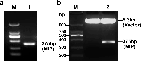 Figure 1. Construction and identification of the pET-28a-MIP recombinant plasmid. (a) PCR amplification to obtain the full-length ORF of the MIP protein. Lane M, DNA ladder (Takara, Dalian, China); lane 1, PCR product. (b) Recombinant plasmids identified by double restriction enzyme digestion. Lane M, DNA ladder (Takara, Dalian, China); lane 1, pET-28a vector; lane 2, pET-28a-MIP recombinant plasmid.