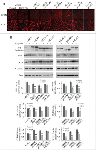 Figure 4. Effect of p62 mutants on the expression of junctional proteins. (A) MDCK cells and MDCK expressing wild-type p62 or p62 domain-deletion mutants cells were subjected to TGFβ treatment for 72 h. Cells were processed for indirect immunofluorescence analysis of occludin (OCLN), and E-cadherin (CDH1). Bar, 10 μm. (B) MDCK cells and MDCK cells expressing wild-type p62 or domain-deletion mutants were left untreated or treated with TGFβ for 48 h. p62 mutants, CDH1, OCLN, and actin expression were analyzed by western blot.