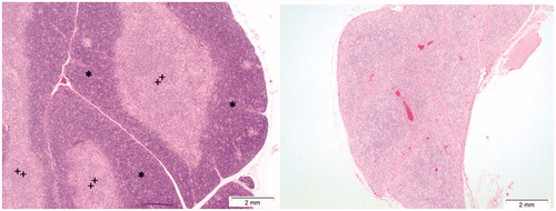 Figure 13. Effects of Cu2CO3(OH)2 NPs on the thymus. The left image shows the histology of a normal thymus of a control animal. Note the extensive presence of lymphocytes in the thymus cortex (asterisks) and medulla (plus). The right image is from day 6 of an animal treated with Cu2CO3(OH)2 NPs 128 mg/kg for five consecutive days (days 1–5). The histology shows lymphoid atrophy as shown by the low number of lymphocytes present resulting in a disappearance of demarcation between cortex and medulla.