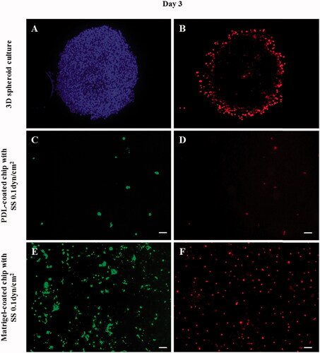 Figure 7. Fluorescent images of cancer cells in the 3D spheroid platform and in a microfluidic chip after DOX treatment. According to the fluorescent images, cancer cells in the 3D spheroid form showed a limited effect of DOX as confirmed by the increased cell number and PI-positive cell number. PI staining (B,D,F: dead cells) confirmed that only the cells of the outer layer of the 3D spheroid were dying, indicating that only the surface cells exposed to DOX were affected, whereas the interior cells were not affected. Additionally, in the presence of flow in the PDL-coated microfluidic channel, the cells were washed out. On the other hand, in the Matrigel-coated channel, cells demonstrated a relatively strong resistance to DOX even in the presence of flow. (A: nuclei/Hoechst, B,D,F: dead cells/PI, and C,E: live cells/Calcein-AM). (scale bar: 200 μm).