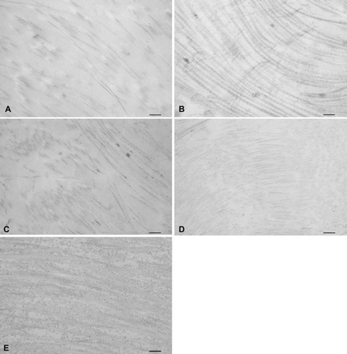Figure 3. Transmission electron microscopic images of (A) trypsin, (B) osmotic, (C) trypsin-osmotic, (D) detergent-osmotic decellularized, and (E) control leaflets. In trypsin (A) and trypsin-osmotic (C) matrices, tightly packed and aligned collagen fibres are absent. Collagen fibres of detergent-osmotic matrices (D) show a decreased density. The collagen structure of the osmotic treated valves (B) is well preserved compared to controls (E). Scale bar 500nm.
