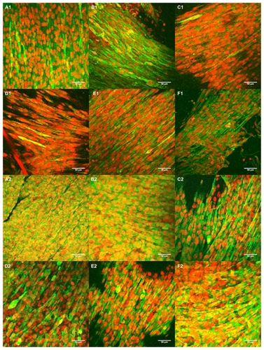 Figure 11 Confocal images of C2C12 seeded for four days on (A) 5PU, (B) SWNT-5PU, (C) MWNT-5PU, (D) 10PU, (E) SWNT-10PU, and (F) MWNT-10PU. (−1) indicates without electrical stimulation and (−2) indicates with electrical stimulation. Myosin heavy chains were stained with fluorescein (green) and cell nuclei were marked with propidium iodide (red).Abbreviations: MWNT, multiwalled nanotubes; SWNT, single-walled nanotubes; 5PU, 5% w/v polyurethane; 10PU, 10% w/v polyurethane.