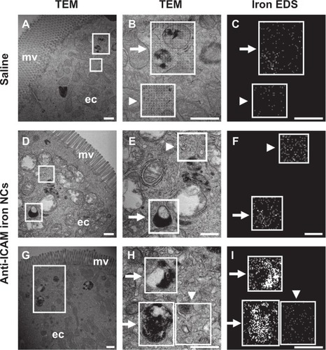 Figure 7 Visualization of epithelial endocytosis of anti-ICAM nanocarriers into GI tissue. Mice were gavaged with saline (A–C) or anti-ICAM-coated iron oxide nanoparticles suspended in NaHCO3 (D–I).Notes: GI tissue was isolated after 10 minutes, processed, and imaged by TEM and iron EDS. In each row, a lower-magnification TEM image of the duodenum (left) is followed by a higher-magnification TEM image (middle) and its corresponding EDS analysis (right). White boxes indicate regions of EDS analysis. Arrows indicate electron-dense vesicular structures while arrowheads indicate non-vesicular structures. Scale bar = 500 nm.Abbreviations: mv, microvilli; ec, enterocyte; ICAM, intercellular adhesion molecule; GI, gastrointestinal; TEM, transmission electron microscope; EDS, energy dispersive X-ray spectroscopy.