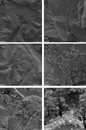 Figure 3. SEM micrographs of Ti-6Al-4V_HA disks inoculated with S. aureus. A, B = day 0; C, D = day 2; E, F = day 10. Scale bars: A, C, E = 40 μm; B, D, F = 4 μm.