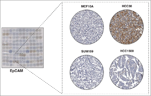 Figure 4. Immunocytochemical staining of EpCAM. The left panel shows a CMA slide stained with a monoclonal antibody against EpCAM. The panel on the right shows a magnified view of 4 representative cell lines showing different levels of expression of EpCAM. Two breast cancer cell lines, SUM159 and HCC1500 and one non-tumorigenic breast epithelial cell line, MCF10A showed very low staining of EpCAM, and HCC38 showed strong staining of EpCAM.