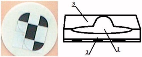 Figure 3. Integrated marker photo (left); marker construction (right): part visible on CT (1), part visible to the video metric tracking system (2), and the adhesive element (3).