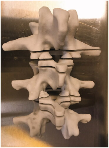 Figure 2. 3D-printed spine model using gypsum had axial cuts.