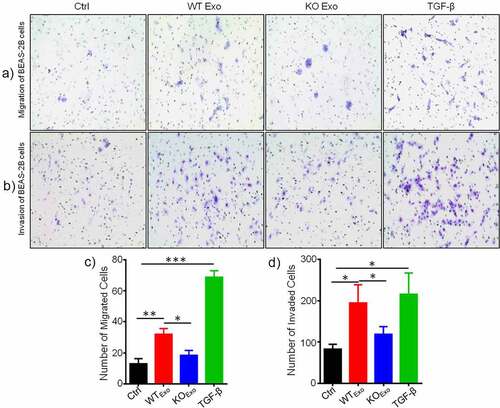 Figure 3. Exosomal HuR promotes the migration and invasion of BEAS-2B cells. Migration assay of BEAS-2B cells (5 × 103 cells/well) incubated with HCT116 WT and HuR KO exosomes (20 µg/ml) or TGF-β1 (5 ng/ml) compared with LHC-9 medium as a control for 72 hours. Cells that migrated into the lower chamber (falcon cell culture insert) were photographed (a) and quantified (c). Matrigel invasion assay of BEAS-2B cells (5 × 103 cells/well) incubated with HCT116 WT and HuR KO exosomes (20 µg/ml) or TGF-β1 (5 ng/ml) compared with LHC-9 medium as a control for 72 hours. Cells that invaded through the Matrigel were photographed (b) and quantified (d).TGF-β1 as a positive control. For each condition, cells were counted from 5 different fields. The student’s t-test was used to analyze differences between the two groups. *p < .05, **p < .01, ***p < .001. The data are presented as the mean ± SEM values. All experiments were repeated at least three times.