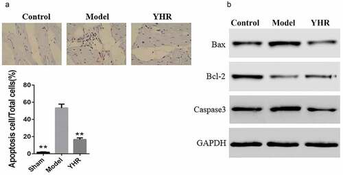 Figure 2. YHR suppressed cell apoptosis of cardiac tissue in HF model