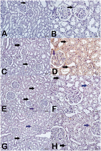 Figure 3. Light microscope image of testicular tissue by light microscopy. Caspase-3 staining.