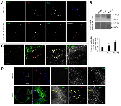 Figure 2. Puromycin DRiPs are autophagy substrates. (A) HeLa cells were treated for 4 h with 3-MA (4 h 3-MA), and puromycin (0,1 µg/µl) was added for the last 5 min (4 h 3MA + 5 min Puro). Cells were Triton X-100 permeabilized prior to fixation, and stained for ubiquitinylated protein (FK2 antibody, polyUbi, red), p62 (blue), and puromycin-containing proteins (Puro, green). Bar, 10 µm. (B) Hela cells received a short pulse of puromycin (10 min, 0.1 µg/ml), were washed and chased in the absence of puromycin in the presence or absence of proteasome inhibitor or 3-MA for the indicated times. Puromycin containing protein was resolved by SDS-PAGE and detected using anti-puromycin antibodies (top) and quantified using ImageJ (bottom), mean ± SEM from three independent experiments are shown, p values (Student’s t-test) were **p > 0.03. (C) Hela cells were stained for ubiquitinylated protein (FK1 antibody, polyUbi, green) and LC3 (red). Bar, 10 µm. (D) HeLa cells were left untreated, or treated for 30 min with puromycin (0.1 µg/µl), and stained for LC3 (red), p62 (blue) and puromycin-containing proteins (Puro, green). Bar, 10 µm.