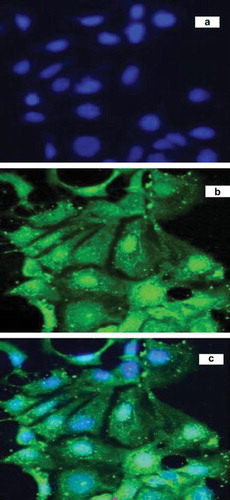Figure 1. Confocal microscopic images of Caco-2 cells after 1 h incubation with OAE-VD3-FITC at 37°C, which were imaged by (a) DAPI channel, (b) FITC channel and (c) the combined DAPI channel and FITC channel, respectively.