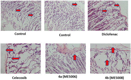 Figure 4. Ulcerogenic effects of the tested pyridazine sulphonates (7a and 7b), diclofenac and celecoxib on the gastric tissue of rats. Histopathological examination was performed using H & E stain and the magnification power of the images was 40X. The red arrows indicated the normal or damaged parts.