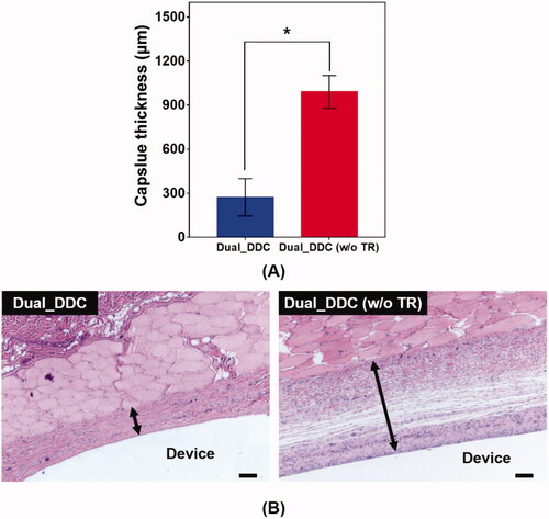 Figure 7. Evaluation of (A) capsule thickness and (B) representative images of the hematoxylin and eosin (H&E)-stained tissues biopsied 30 days after DDC implantation. Error bars represent the standard deviation (n = 25). *Statistically significantly different between Dual_DDC and Dual_DDC (w/o TR) (p<.05). The double-ended arrow indicates the capsule thickness. The scale bars are 200 μm.