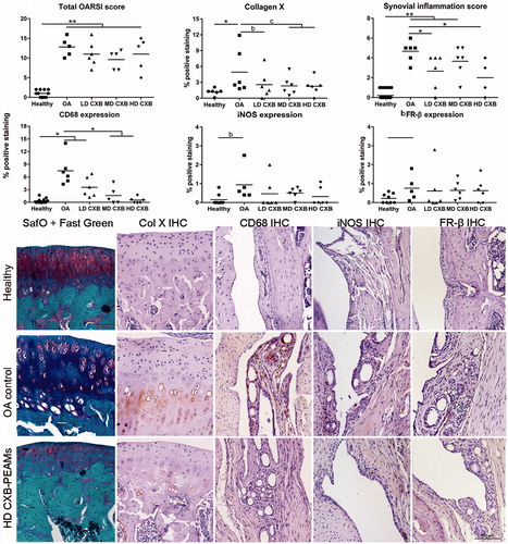 Figure 5. Histological grading and immunohistochemical analysis of the medial tibial. OA induction led to an increase in OARSI score, collagen X deposition and synovial inflammation. Celecoxib-loaded PEAMs were able to decrease synovial inflammation, macrophage presence and collagen X deposition. *p < .05; **p < .01; a: medium effect size (ES); b: large ES; c: very large ES. OA: osteoarthritic control knees; LD: low dose; MD: middle dose; HD: high dose celecoxib. HD CXB-PEAMs: high dose celecoxib-polyesteramide microspheres; IHC: immunohistochemistry.