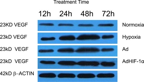 Figure 4 Representative Western Blot images of VEGFA expression in BMEC.