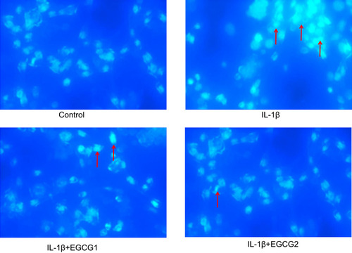 Figure 3 EGCG treatment decreased cell apoptosis in IL-1β-stimulated MIN6 cells. MIN6 cells were stimulated with IL-1β followed by co-cultivation with low (1mM) or high (5mM) EGCG for 24 h. Morphological analysis of the nuclei were stained using Hoechst 33258. Red arrows indicate apoptotic MIN6 cells. Representative images for each group (n=6 per group) are shown (magnification×400).