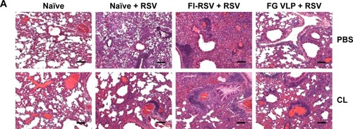 Figure 7 CL-mediated depletion of alveolar macrophages differentially modulates histopathology and mucus production.Notes: The lung tissues from mice were collected 5 days after RSV challenge. The lung tissues were fixed with 10% neutral buffered formalin solution and embedded in paraffin. (A) Histology photographs of hematoxylin and eosin staining. (B) Histopathological scores. (C) Histology photographs of PAS staining. (D) Percentages of PAS-positive area. Histopathological scores were determined in the airways, blood vessels, and interstitial spaces. PBS panel: mock (PBS)-treated groups. CL panel: CL-treated groups. Representative histology photographs from each group were taken and scale bars indicate 100 μm. The reproducible data were obtained from two independent experiments (n=3–5). Statistical significance was determined using an unpaired two-tailed Student’s t-test. Error bars indicate means ± standard error of the mean of concentration or ratios from individual animals (n=5). *P<0.05; **P<0.01.Abbreviations: CL, clodronate liposome; FG VLP, a combination of fusion and glycoprotein virus-like nanoparticles; FI-RSV, formalin-inactivated RSV; PAS, periodic acid–Schiff; PBS, phosphate-buffered saline; RSV, respiratory syncytial virus.