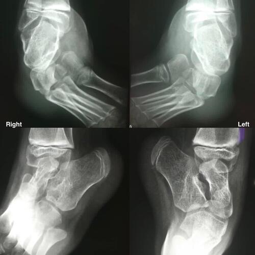 Figure 1 The patient’s plain radiographs before treatment.