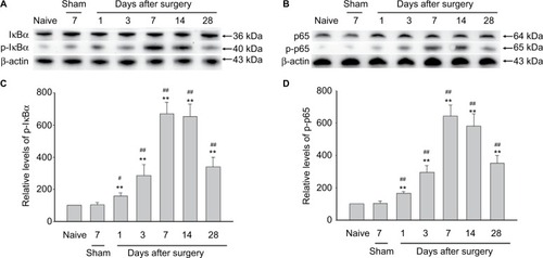 Figure 1 NF-κB activation in rat DRG after autologous implantation of NP.