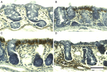 Figure 5. APC immunohistochemistry of DSS-induced colitis in young rats. APC was immunonegative in the colon of young rats (A), but was immunopositive at DSS-3d (B). APC immunoreactivity was more evident in the surface epithelium at DSS-5d (C) and in the lamina propria (asterisk) at DSS-7d (D). Scale bar = 50 µm.