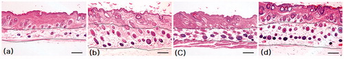 Figure 3. Transverse section of dorsal skin specimen of different treatment groups. Control (a), Minoxidil (b), P. multiflorum (c), C. zawadaskii (d) stained with haematoxylin and eosin (H&E). Dotted lines indicate the junction of dermis and subcutis. Scale bar 500 µm.