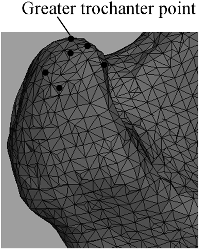 Figure 3. Schematic diagram of searching for greater trochanter point.