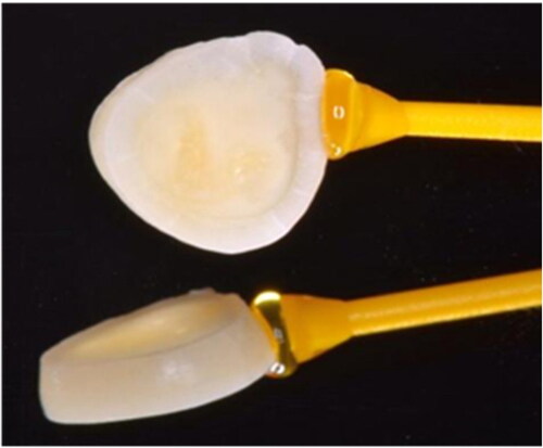 Figure 1. Dentin discs slices.