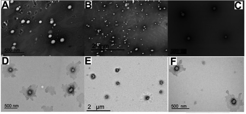 Figure 2 TEM images of DOX.HCl (A and B), Blank LPHNPs (C and D), and DOX base (E and F) loaded LPHNPs.Abbreviations: DOX, doxorubicin; DOX.HCl, doxorubicin hydrochloride; LPHNPs, lipid polymer hybrid nanoparticles; TEM, transmission electron microscopy.