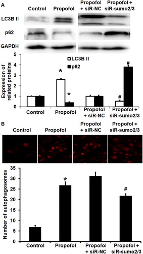 Figure 4. Effect of propofol on the autophagy of untransfected HUVECs and those without or with interference of SUMO2/3 expression. (A) Expression of LC3B II and p62 proteins in HUVECs of control group, propofol group, propofol + siR-NC group and propofol + siR-SUMO2/3 group. Western blotting was used to determine protein expression. *p < 0.05 compared with control group; #p < 0.05 compared with propofol + siR-NC group. (B) Number of autophagosomes in HUVECs of control group, propofol group, propofol + siR-NC group and propofol + siR-SUMO2/3 group. Laser scanning confocal microscopy was used to determine the number of autophagosomes. *p < 0.05 compared with control group; #p < 0.05 compared with propofol + siR-NC group.