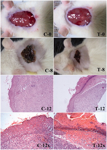 Figure 9. Wound healing and histological evaluation of PLGA–curcumin microparticles in SD rats. (C-0) Control – initial day wound (C-8) Control – 8th day wound (C-12) Control – 12th day wound (at 10× magnification) (C-12x) Control – 12th day wound (at 40× magnification). (T-0) PLGA–curcumin microparticles treated – initial day wound (T-8) PLGA–curcumin microparticles treated – 8th day wound (T-12) PLGA–curcumin microparticles treated - 12th day wound (at 10× magnification) (T-12×) PLGA–curcumin microparticles treated - 12th day wound (at 40× magnification).
