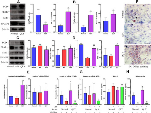 Figure 5 Effects of QLY on PPAR-γ-mediated physiological functions of (pre)-adipocytes in vitro. (A) expression of protein NAMPT, SIRT1, PPAR-γ and SCD-1in pre-adipocytes cultured by either normal or QLY-containing rat serum; (B) quantification results of assay (A); (C) expression of protein NAMPT, SIRT1, PPAR-γ and SCD-1in pre-adipocytes co-cultured with PBMCs derived from normal healthy, AIA control or QLY-treated AIA rats; (D) quantification results of assay (C); (E) expression of mRNA PPAR-γ and SCD-1in pre-adipocytes obtained from assay (C); (F) varied differentiation potentials of adipocytes cultured in serum collected from normal healthy, AIA control or QLY-treated AIA rats, and the intracellular fat droplets were dyed with Oil Red O; (G) expression of mRNA PPAR-γ and SCD-1in LPS-primed pre-adipocytes in the presence of QLY-containing rat serum or in the combination of T0070907; (H) levels of MCP-1 and adiponectin in culture medium collected from assay (G). Statistical significance: (B) **p < 0.01 compared with cells cultured by normal rat serum; (D and E) *p < 0.05 and **p < 0.01 compared with cells co-cultured with PBMCs derived from AIA models, #p < 0.05 and ##p < 0.01 compared with cells co-cultured with PBMCs derived from normal healthy rats; (G and H) *p < 0.05 and **p < 0.01 compared with pre-adipocytes cultured with normal rat serum, #p < 0.05 and ##p < 0.01 compared with pre-adipocytes cultured with normal rat serum in the presence of LPS, $$p < 0.01 compared with LPS-primed pre-adipocytes cultured with QLY-containing rat serum.